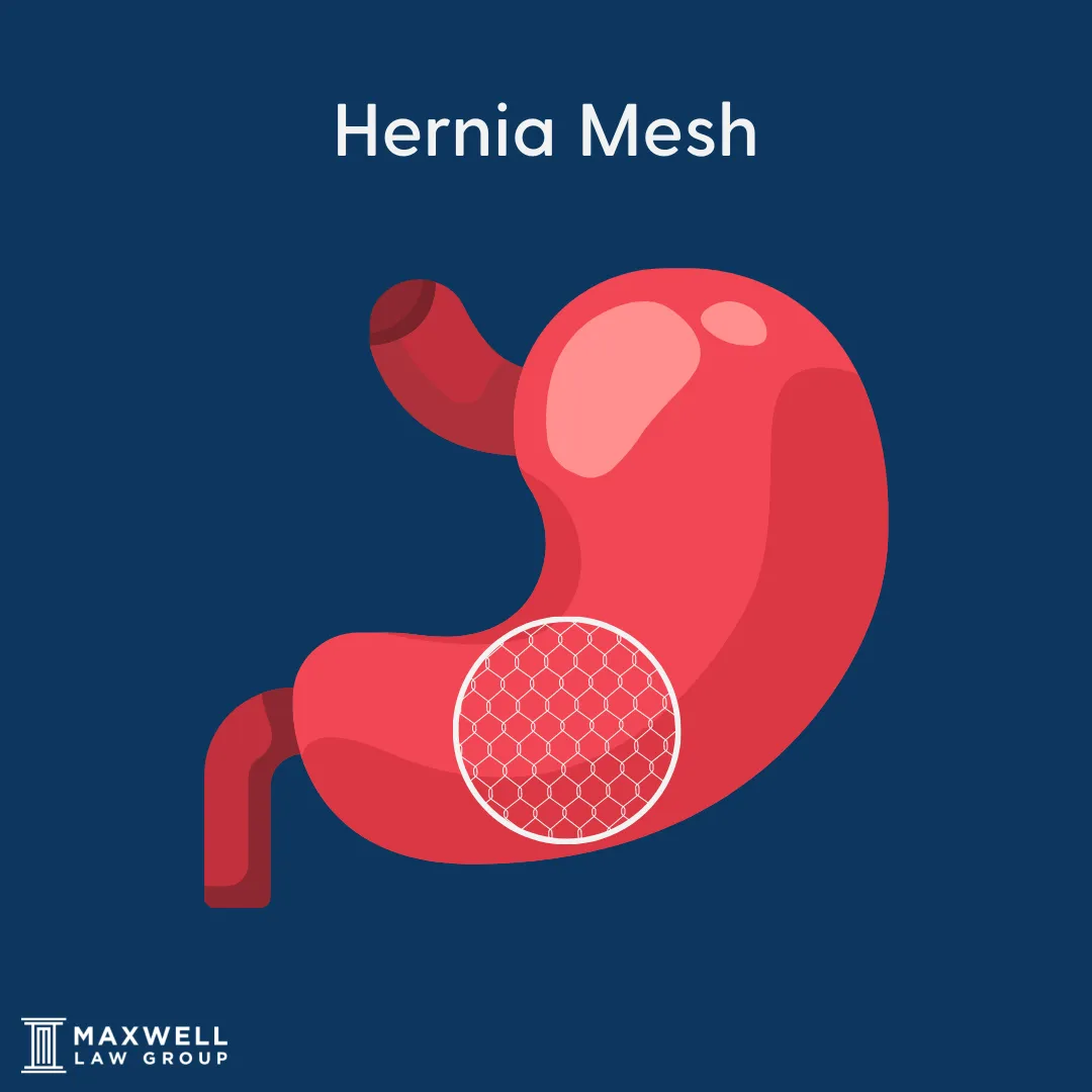 hernia mesh purpose